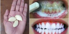 انقذ أسنانك من التسوس.. تبيض الأسنان كالؤلؤ والتخلص من الجير والأصفرار نهائيا بدون ليزر